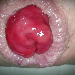 Extreme Prolapse Closeup Shemale Anal Masturbating Porn 85